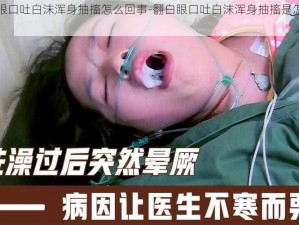 翻白眼口吐白沫浑身抽搐怎么回事-翻白眼口吐白沫浑身抽搐是怎么回事？