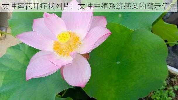 女性莲花开症状图片:女性生殖系统感染的警示信号