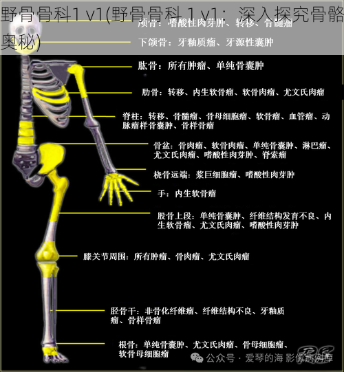野骨骨科1 v1(野骨骨科 1 v1：深入探究骨骼奥秘)