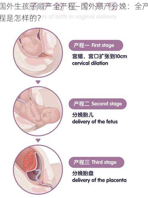 国外生孩子顺产全产程—国外顺产分娩：全产程是怎样的？